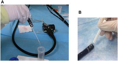 Sterile Reverse Osmosis Water Combined with Friction Are Optimal for Channel and Lever Cavity Sample Collection of Flexible Duodenoscopes